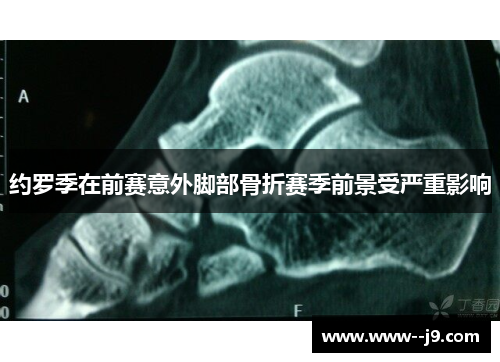 约罗季在前赛意外脚部骨折赛季前景受严重影响 约罗季在前赛意外脚部骨折赛季前景受严重影响
